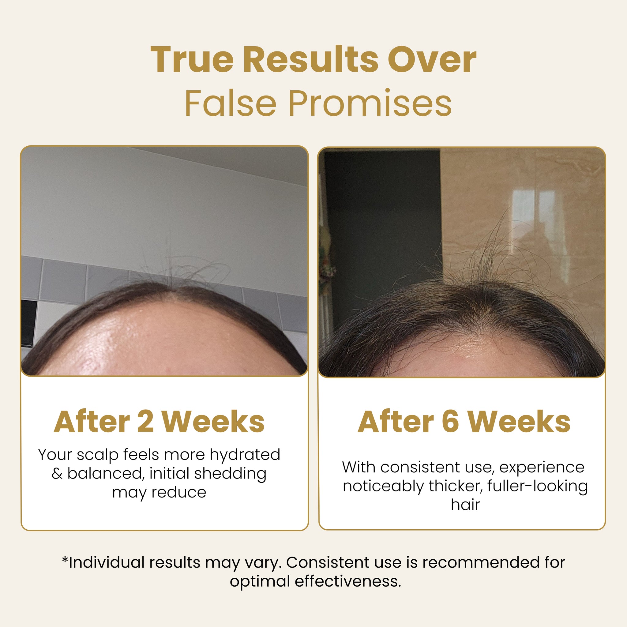 Holiday Hair Growth Bundle