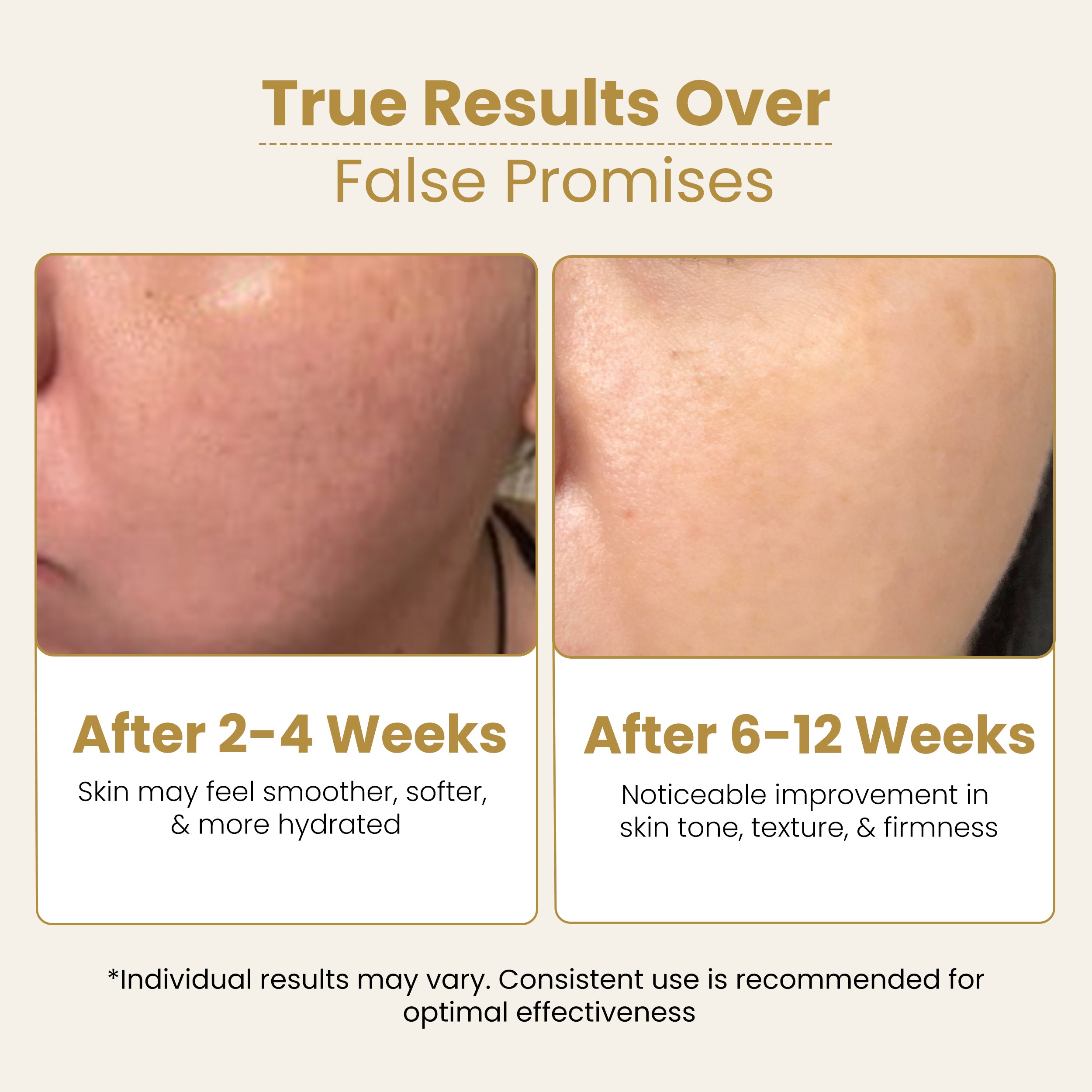 Anti-Manchas Skincare Kit