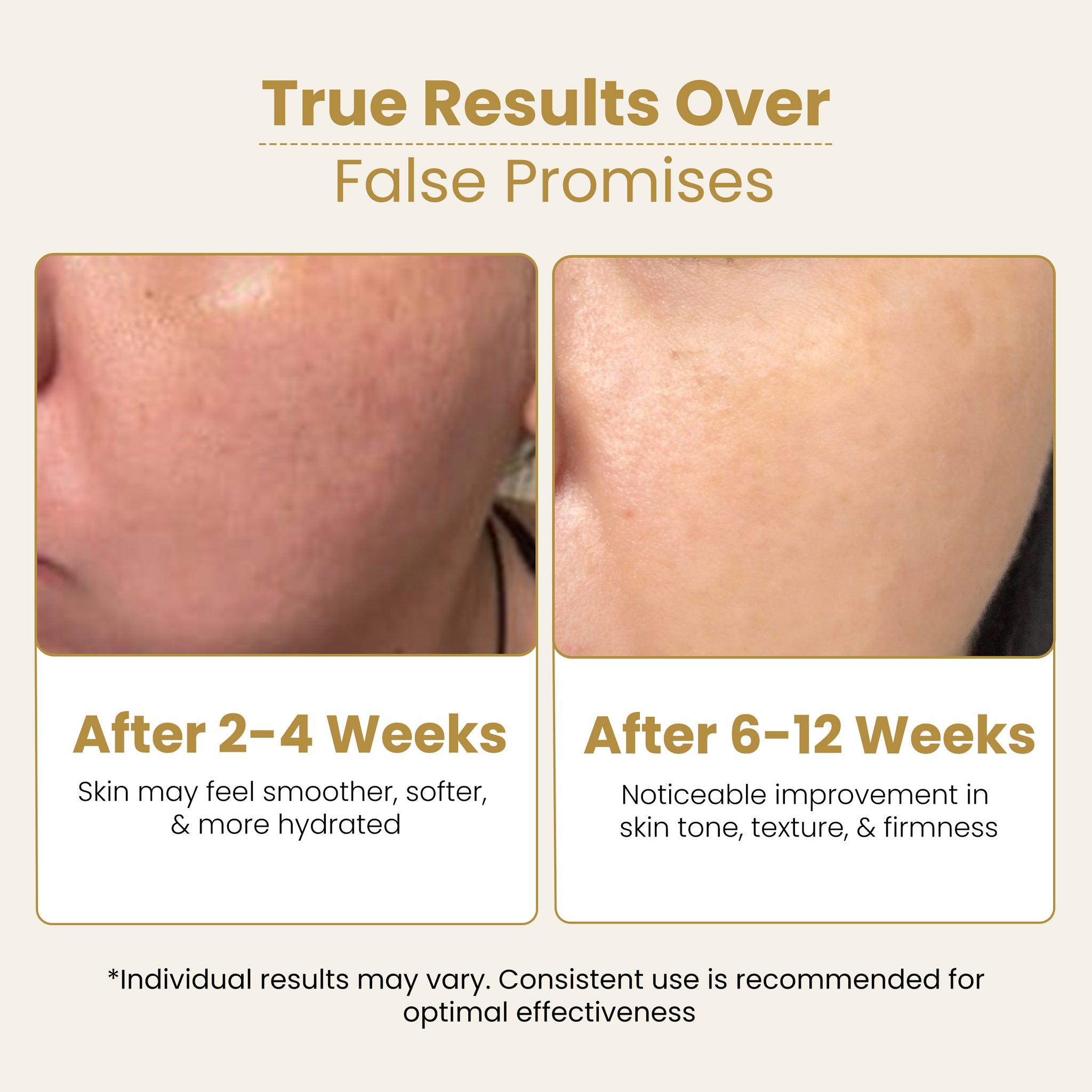 Anti-Manchas Skincare Kit