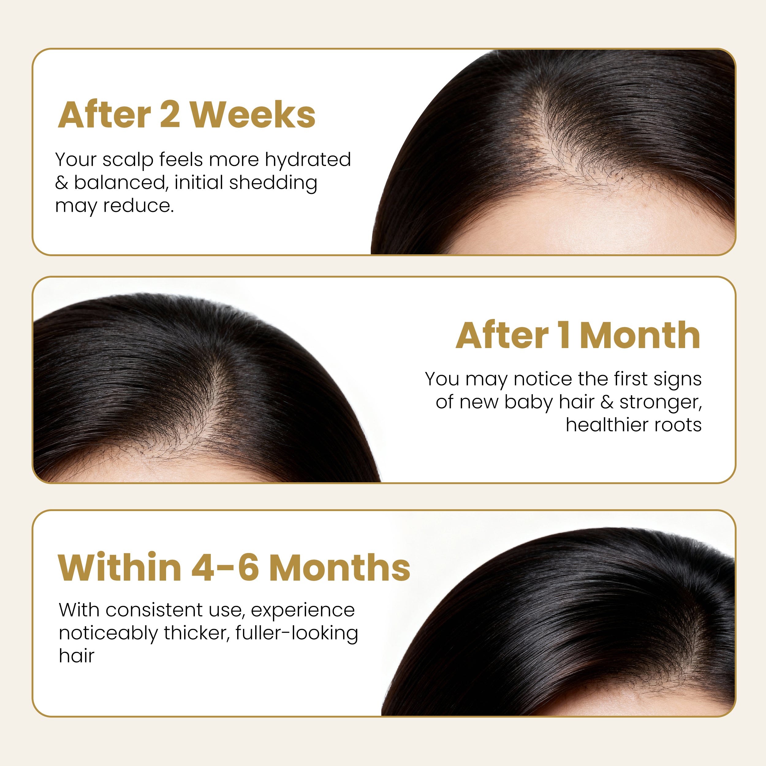 Hair Tonic Minoxidil + Bergamota